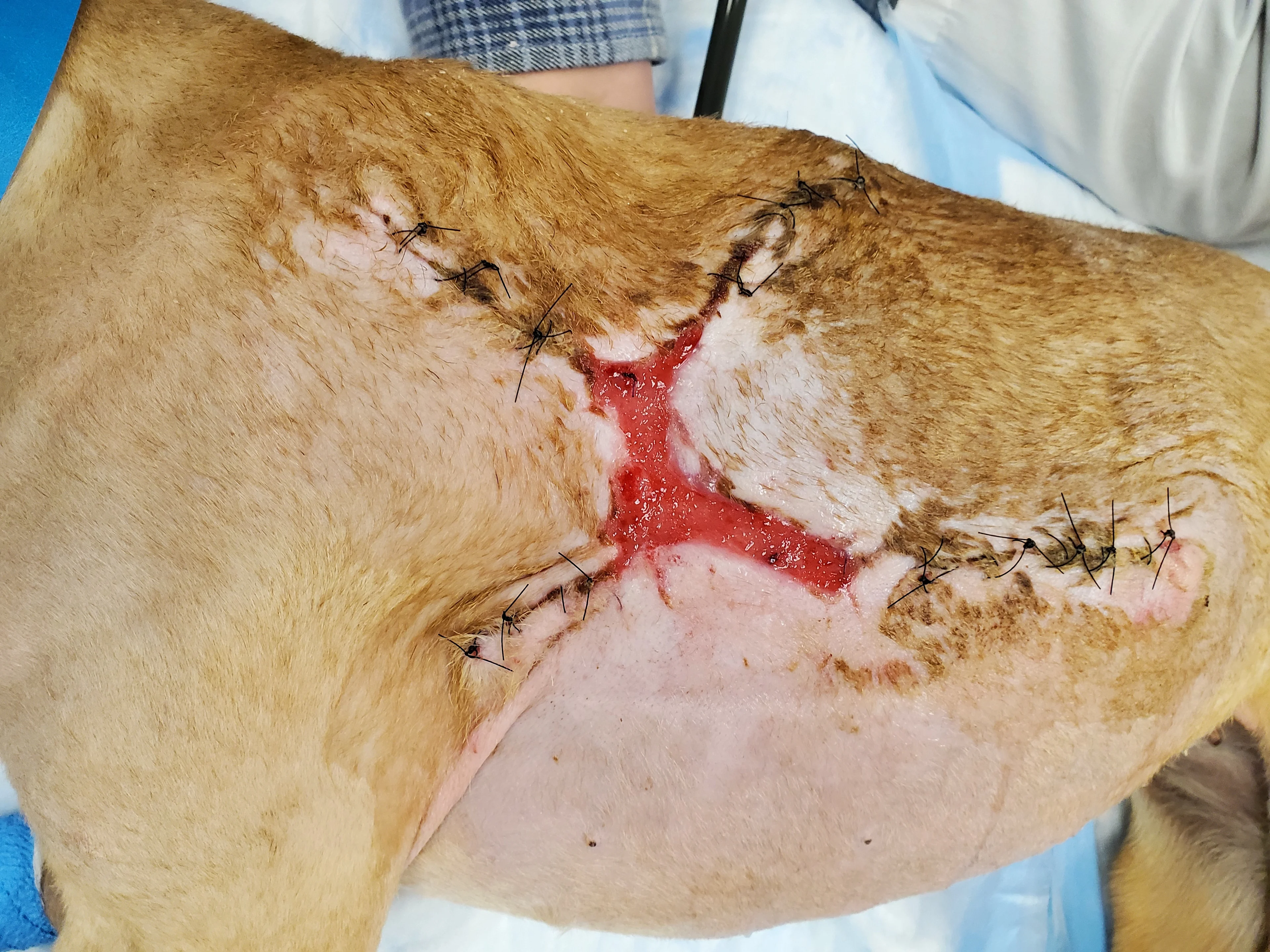 A post op photo showing wound healing progress.