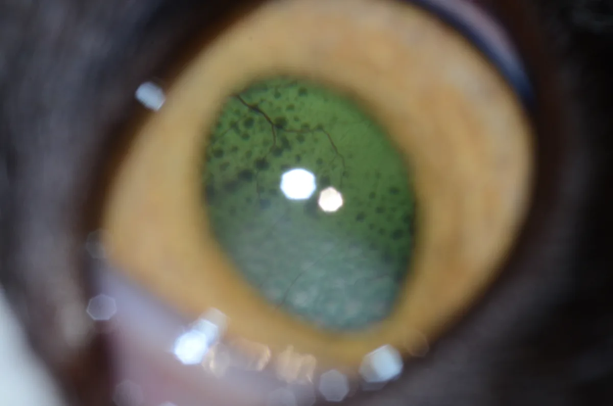 Lesions on the retina of a cat.