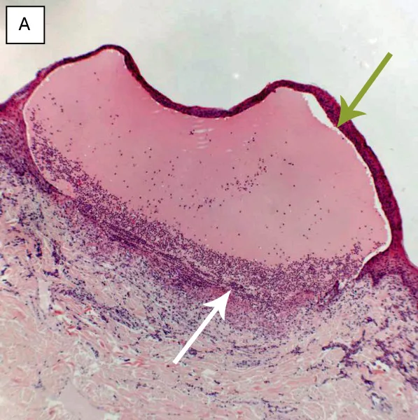 selected slide image