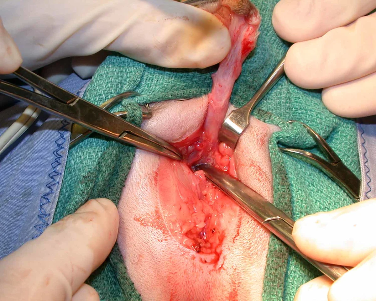 A: Intraoperative photo showing the ventral penile ligament. B: Intraoperative photo showing transection of the ventral penile ligament with surgical scissors.