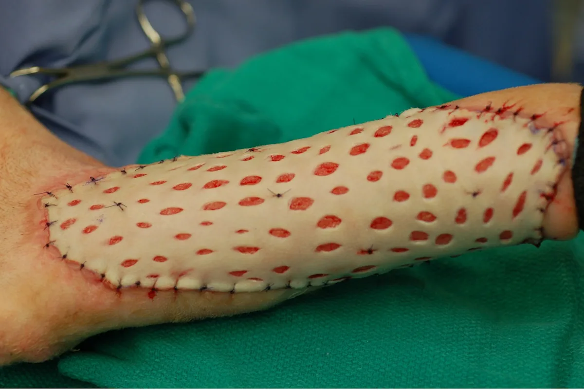 Skin graft on the leg of a dog.