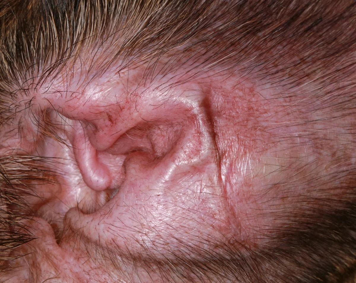 selected slide image