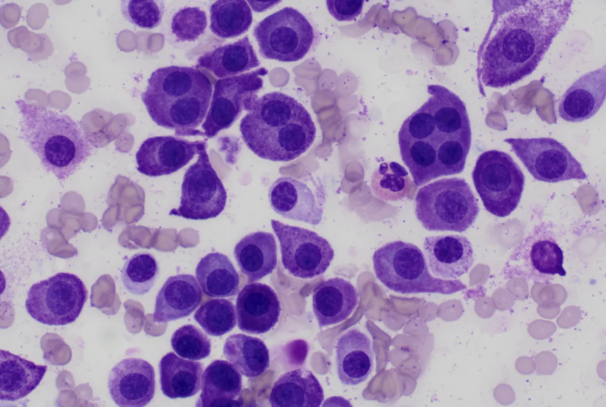 Multiple purple-staining cells with dark-purple single to multiple nuclei.