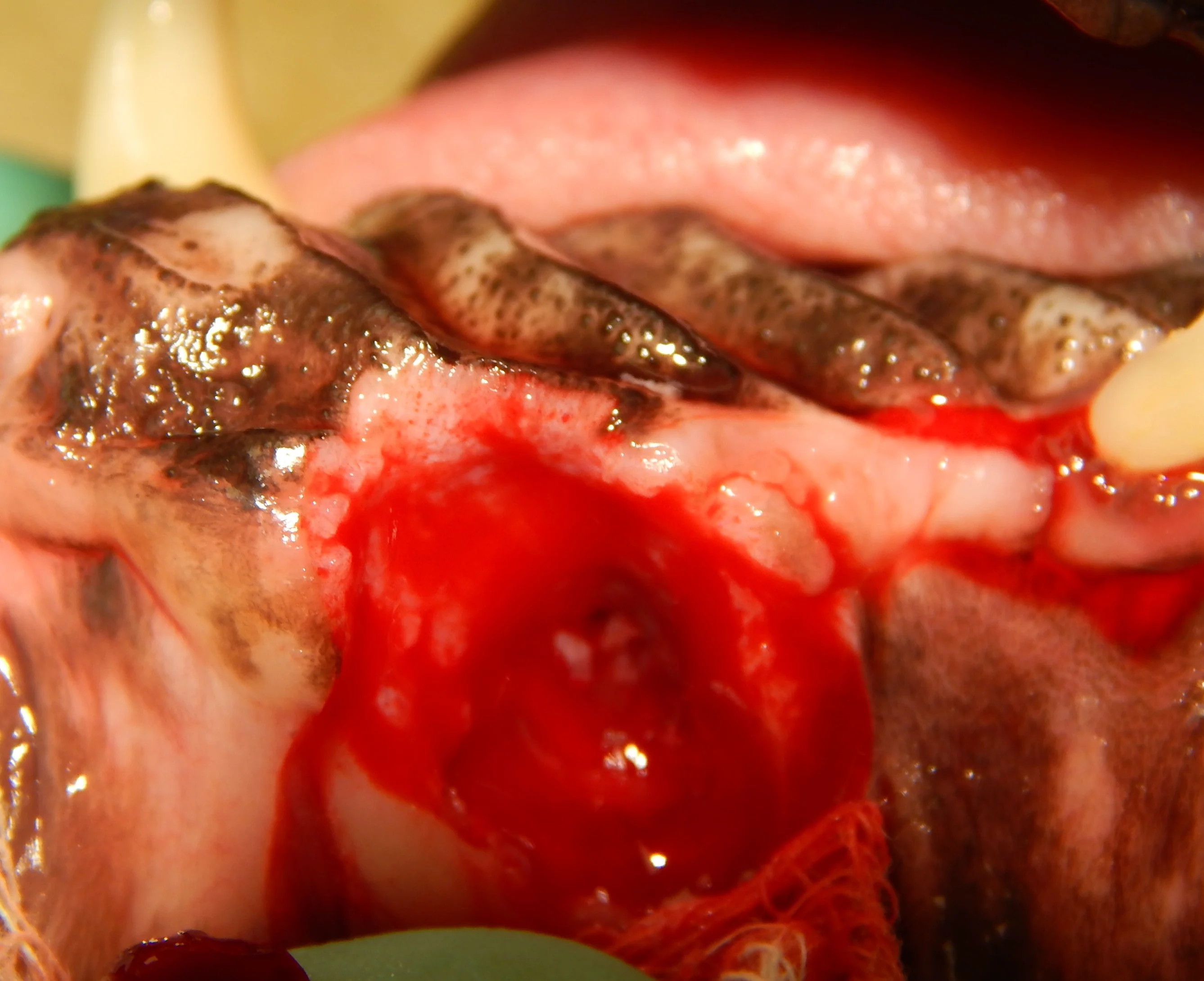 Two photographs showing the use of a diamond burr to facilitate healing of a mucogingival flap. 
