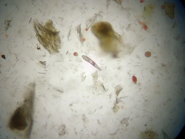 A microscopic image of a skin scrape showing an adult mite.