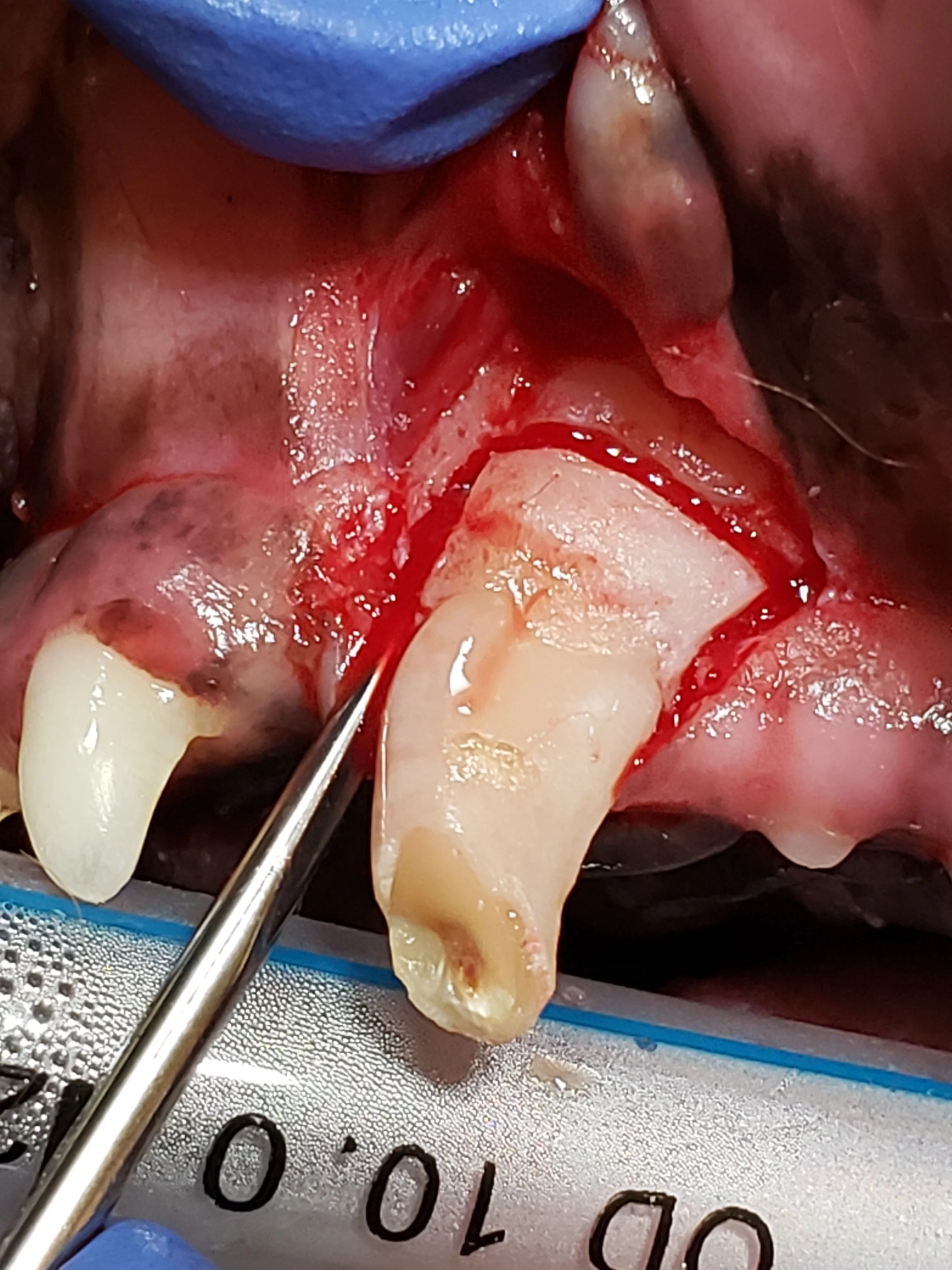 Winged dental elevator shown being inserted into periodontal ligament space around canine tooth root.