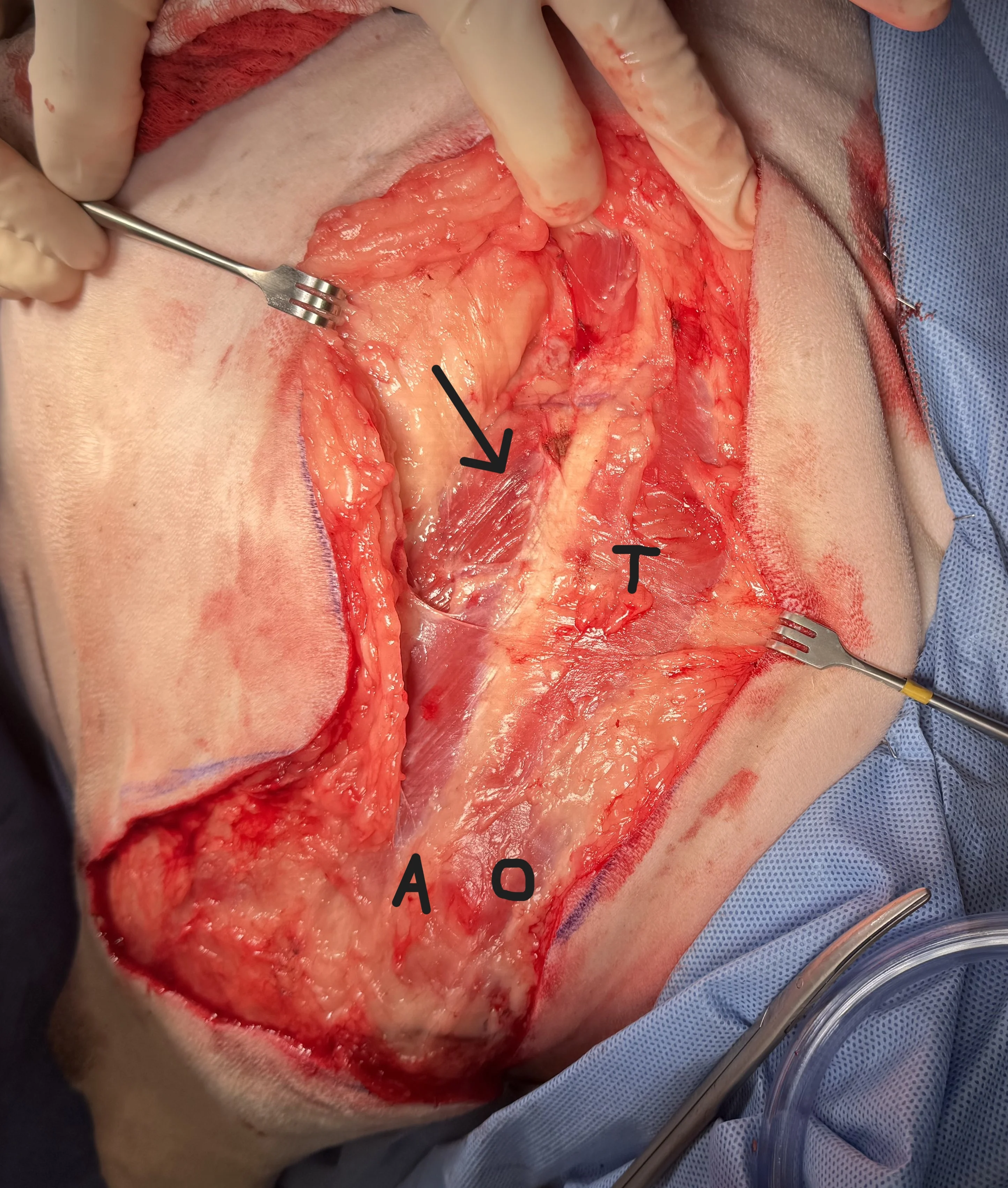 Retractors held on either side of large incision over right forelimb with labels over relevant anatomical landmarks.