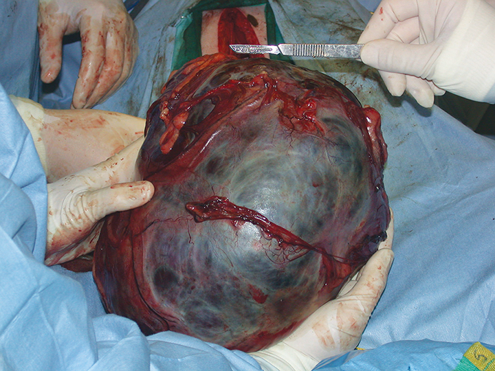what causes a tumor on a dogs spleen
