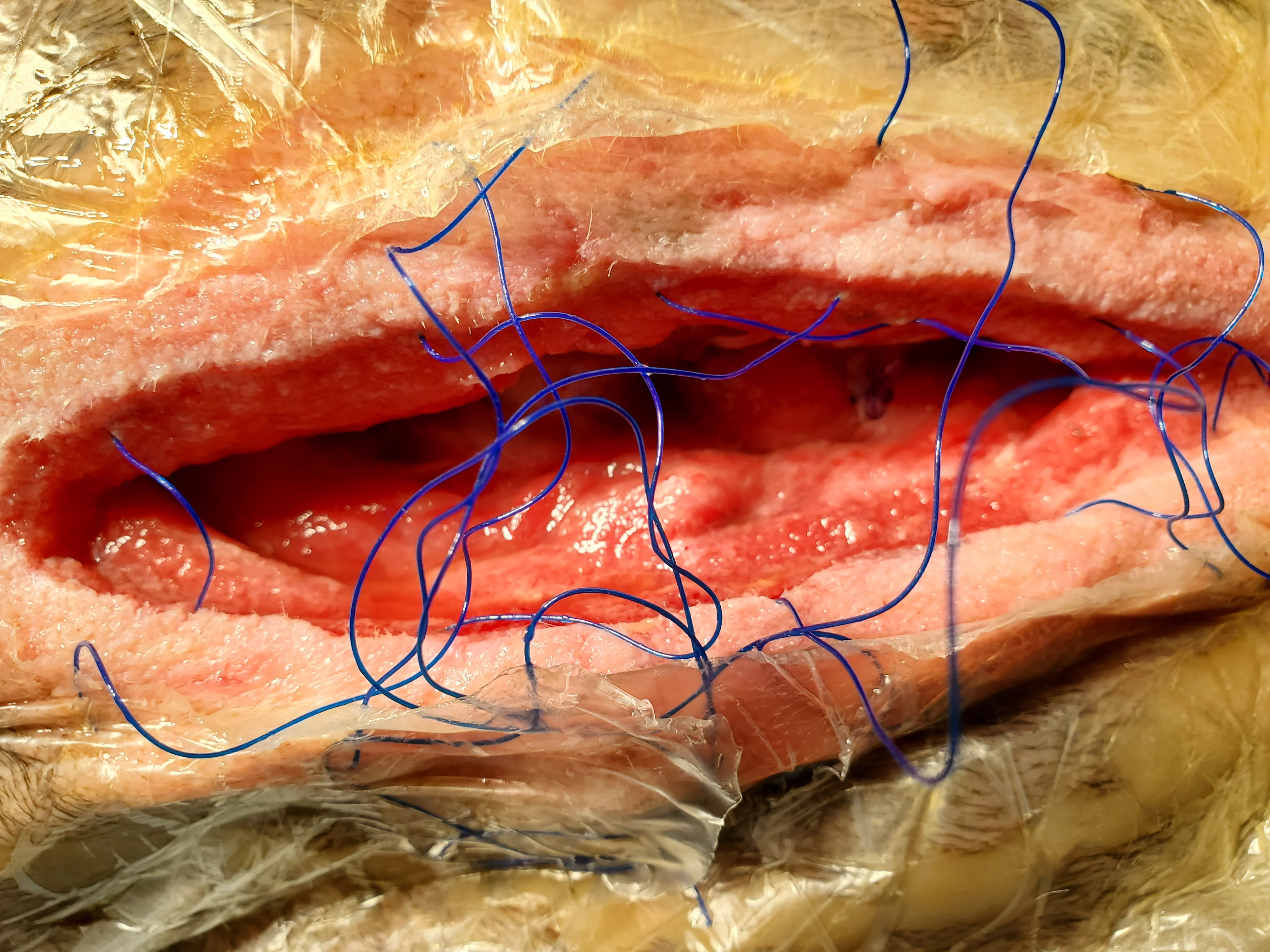 A close-up of the healing open incision.