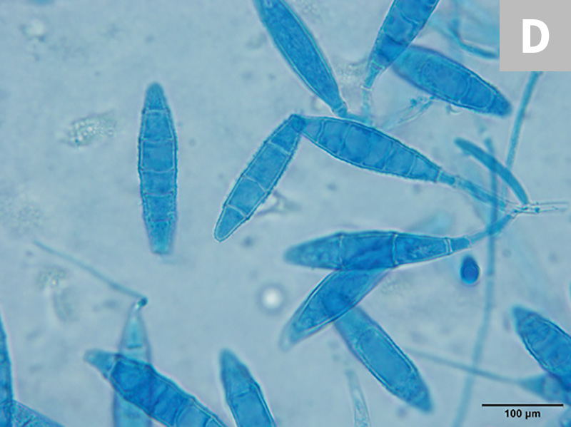 ringworm under microscope