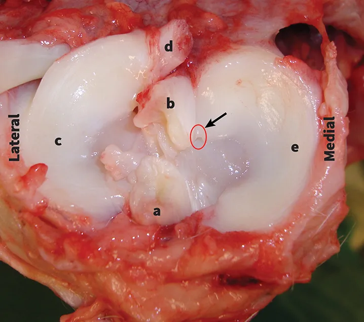 Gross image of disarticulated stifle with meniscal elements labeled.