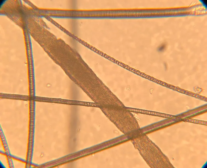 Several magnified hair shafts including one that is wider than the others.