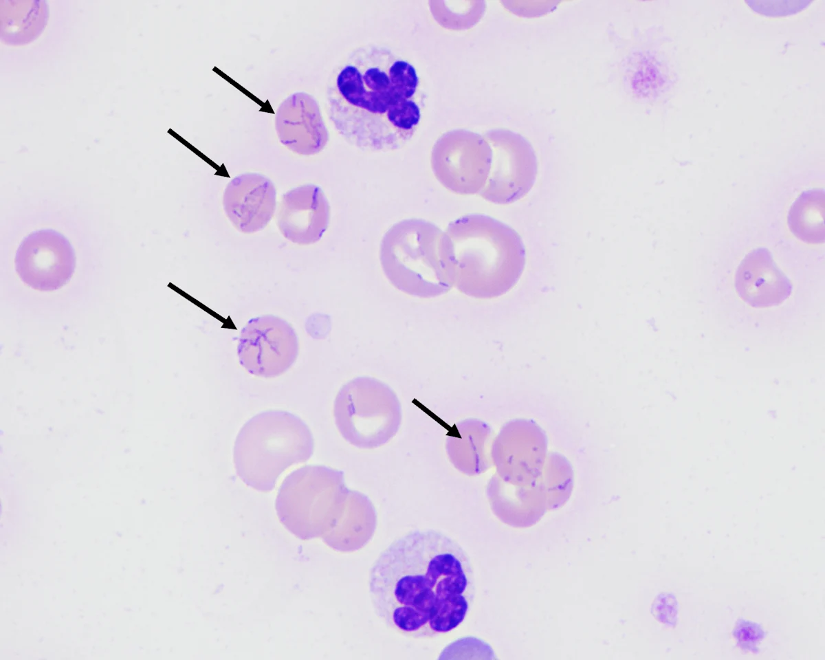 Arrows pointing to red blood cells with multiple cocci on surface.