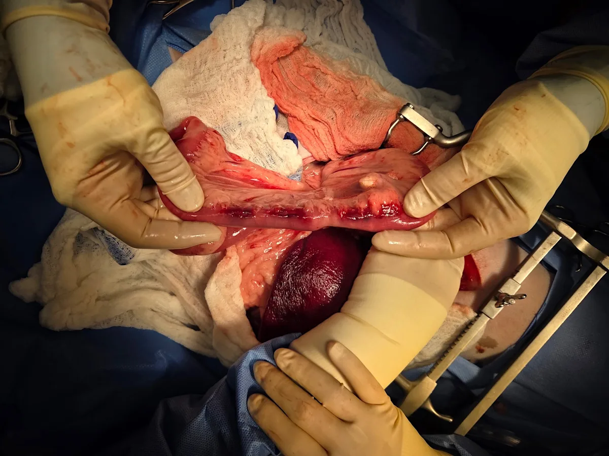 Intestinal surgery in a dog.