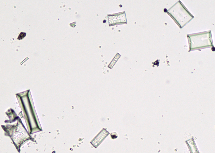 Ammonium magnesium phosphate shop crystals in cat urine