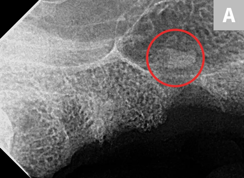 selected slide image