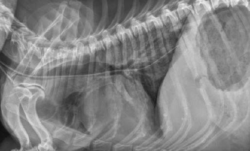 Nasoesophageal & Nasogastric Tube Placement | Clinician's Brief