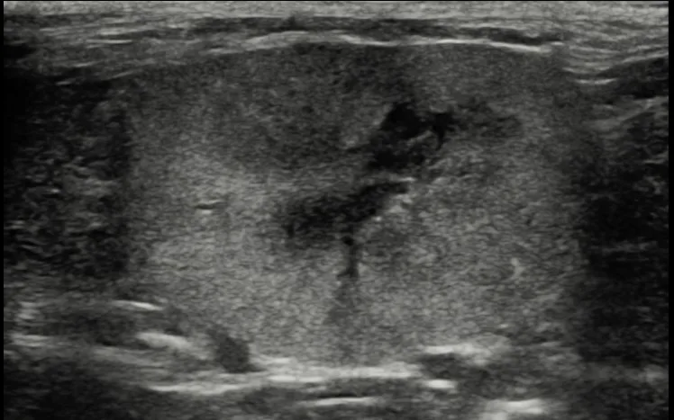 An ultrasound view of a feline kidney.