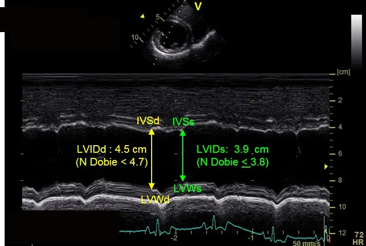 M-mode echocardiogram showing measurements for cardiac wall thickness and chamber dimension in dog with stage B1 DCM.