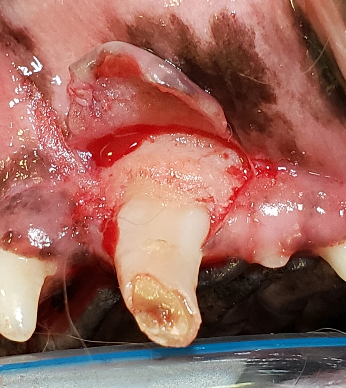 Elevation of mucosal flap over canine tooth using periosteal elevator and image of flap reflected away from bone.