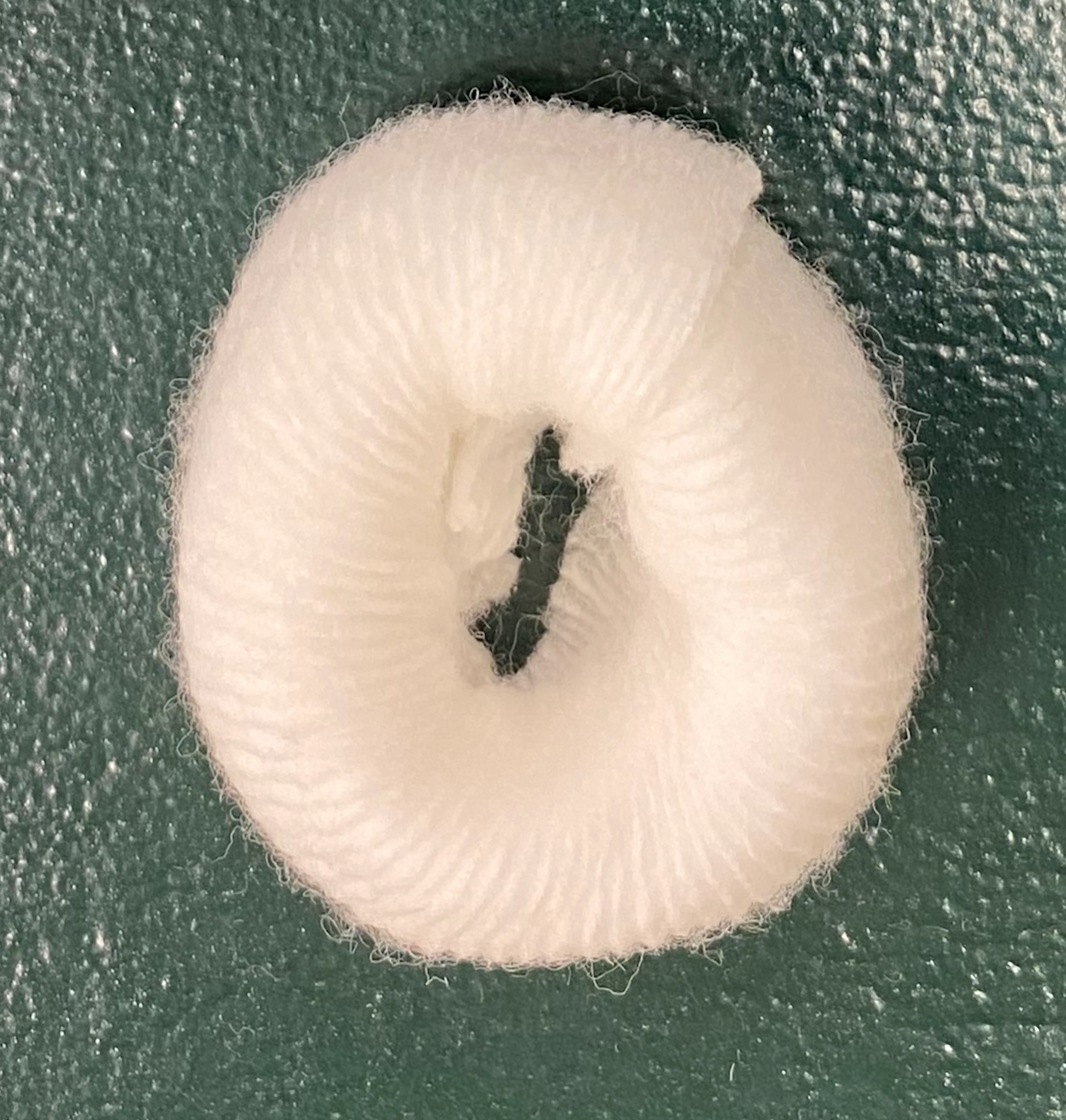 Two examples of donuts used over bony prominences when placing a bandage.