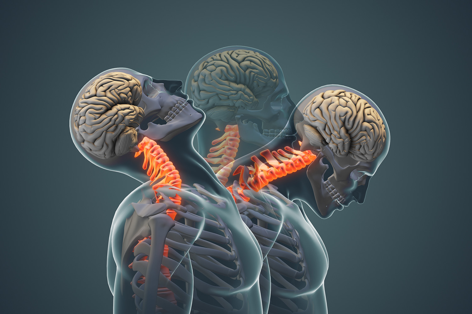3D-medical-animation-company