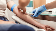 Creatinine Blood Test How To Understand Your Results GoodRx