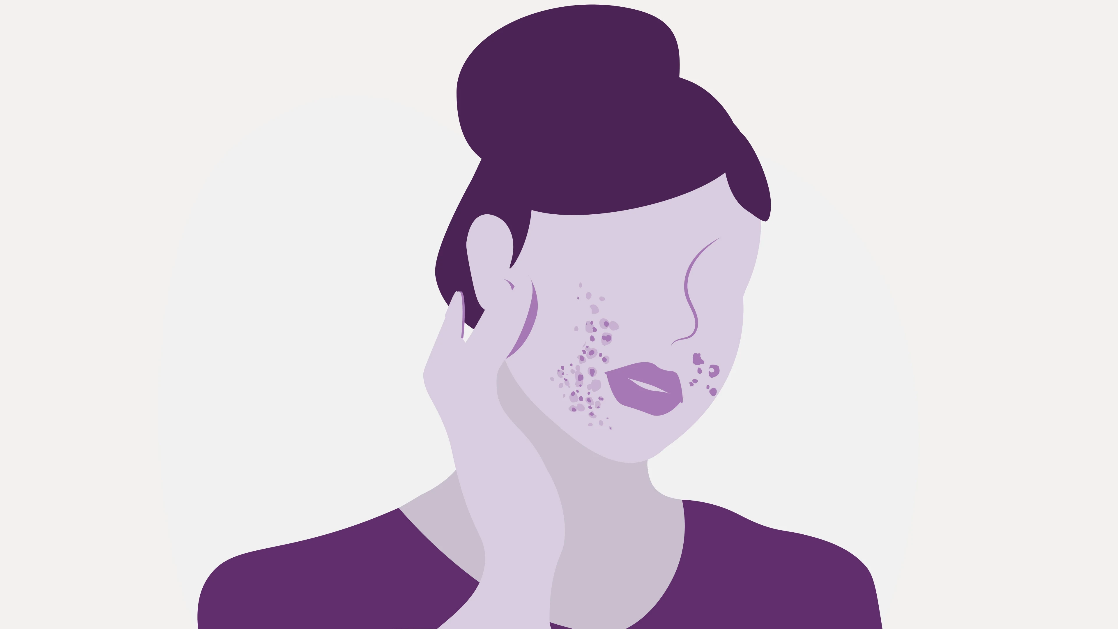 How Does Stress Cause Acne & How to Combat It