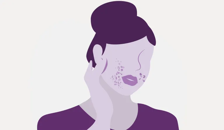 How Does Stress Cause Acne & How to Combat It