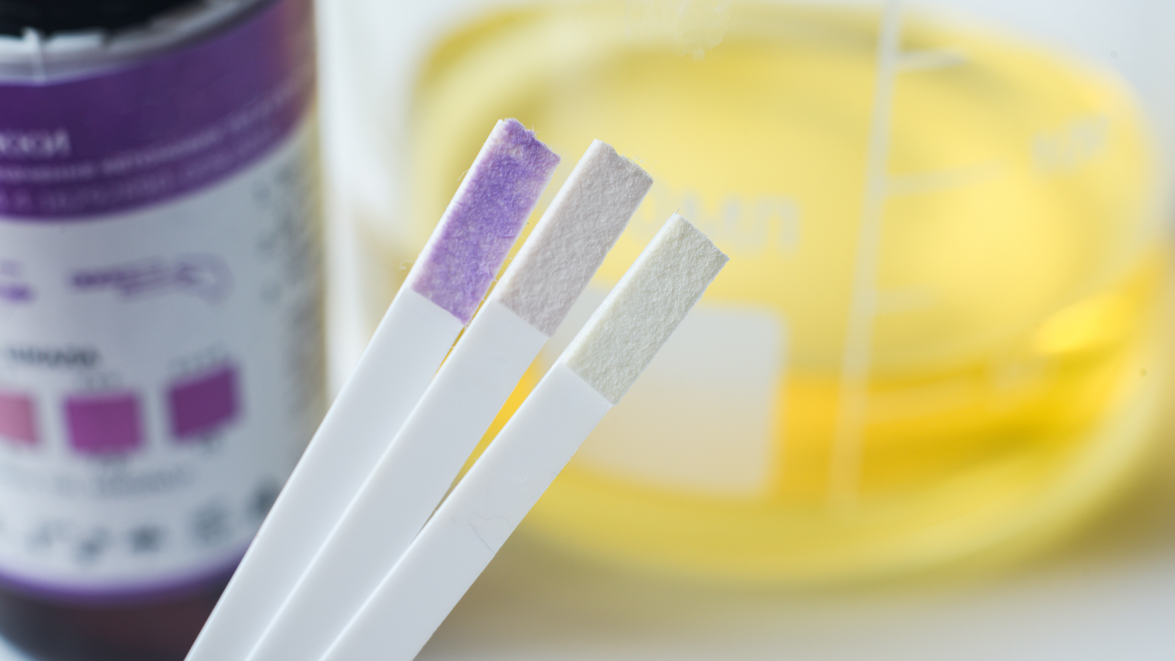 False-Positive Drug Tests: What Can Cause Them? - GoodRx