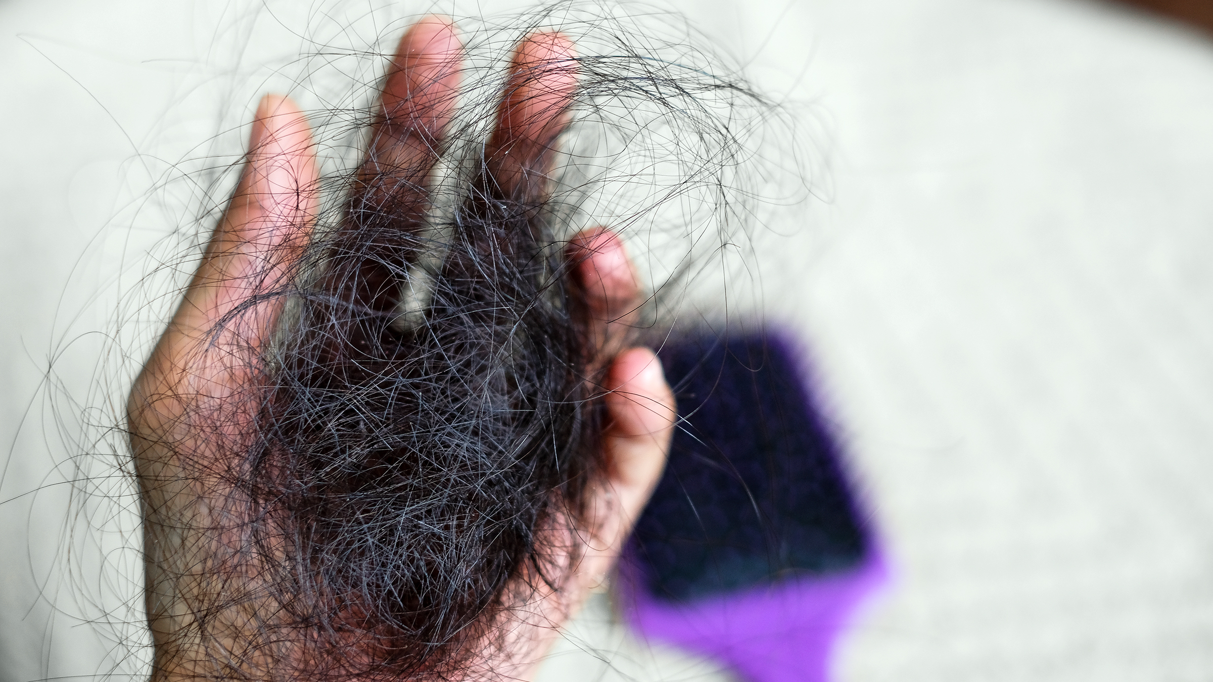 Scalp Conditions: Causes, Treatment, and Pictures