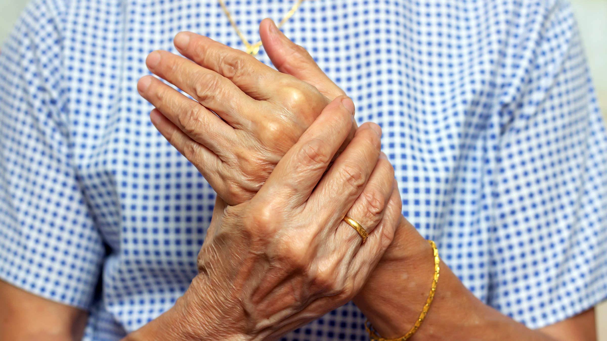 What are the signs of arthritis in the hands? - UChicago Medicine