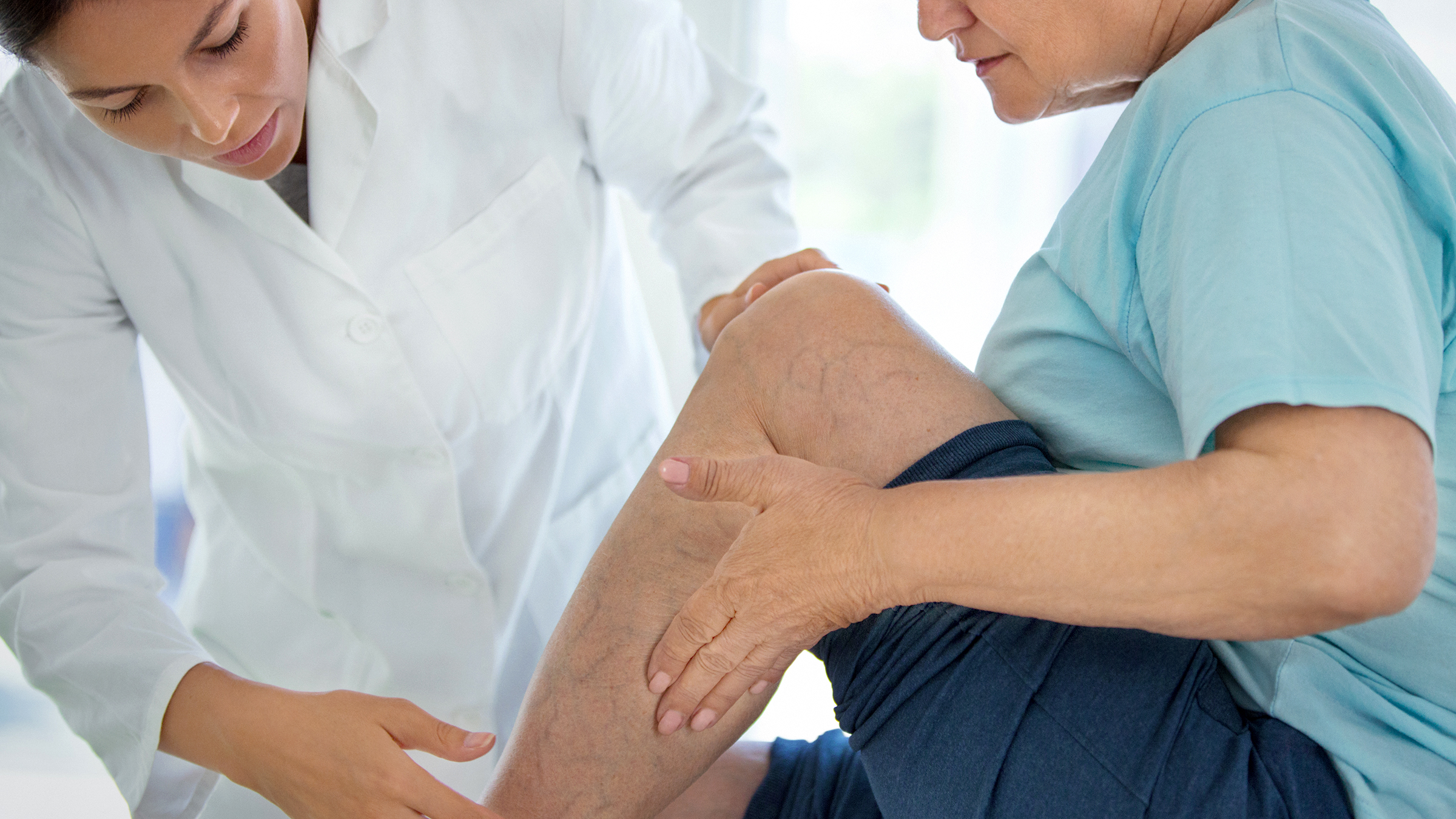 Treatment Options for Varicose Veins