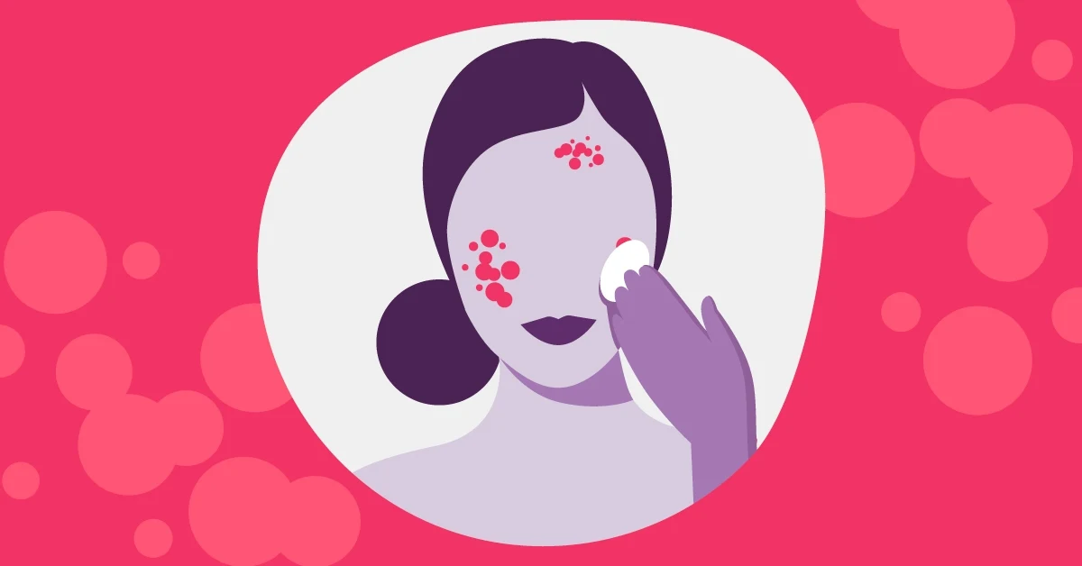 5 Reasons Rosacea Flares Up in The Summer