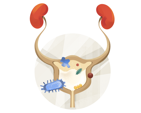 uti-causes-symptoms-medications-more-goodrx