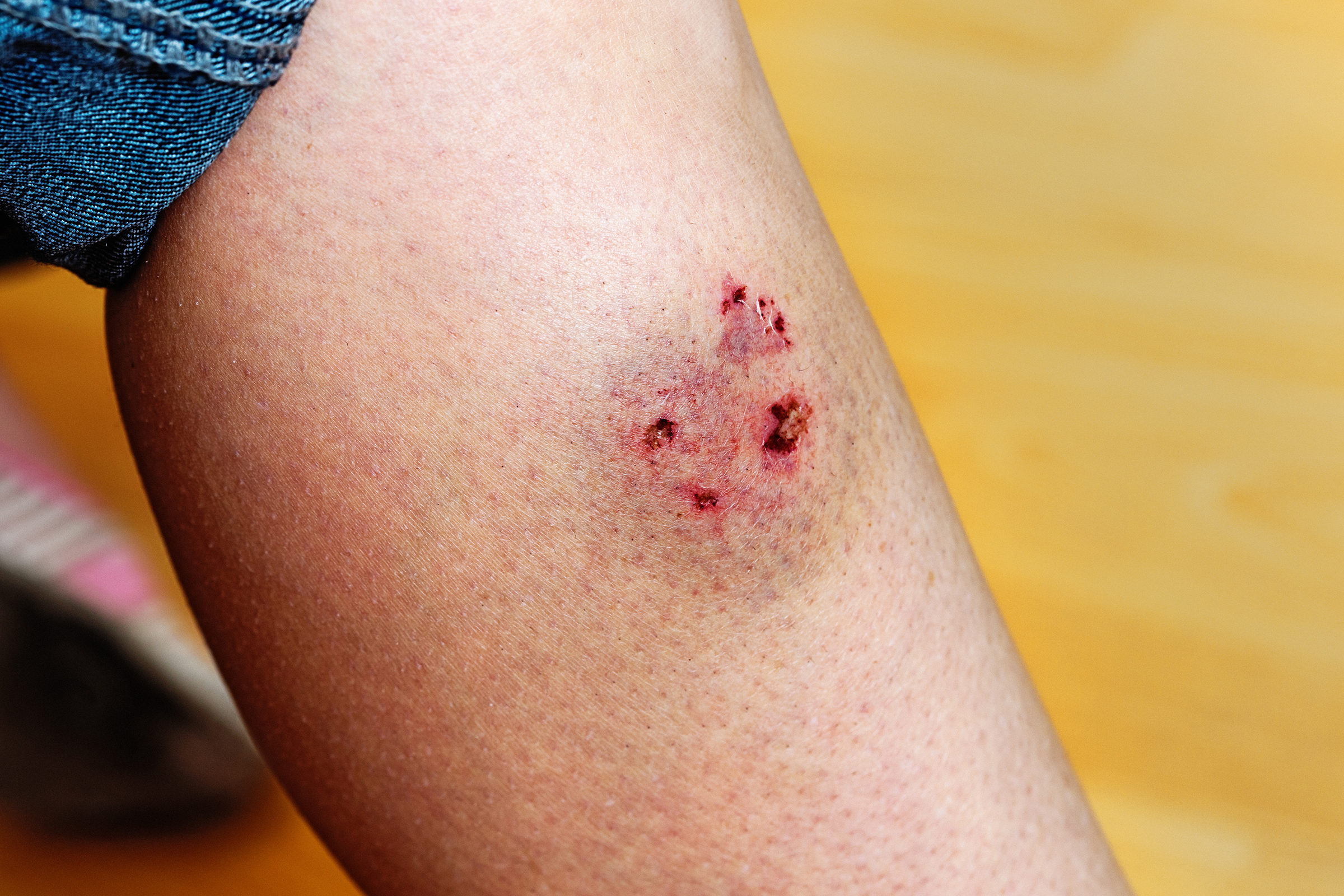 ringworm topical treatment for dogs
