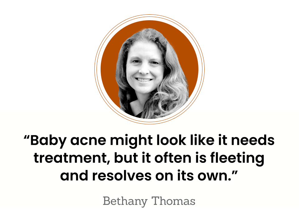 This is a photo of Bethany Thomas. “Baby acne might look like it needs treatment, but it often is fleeting and resolves on its own.”