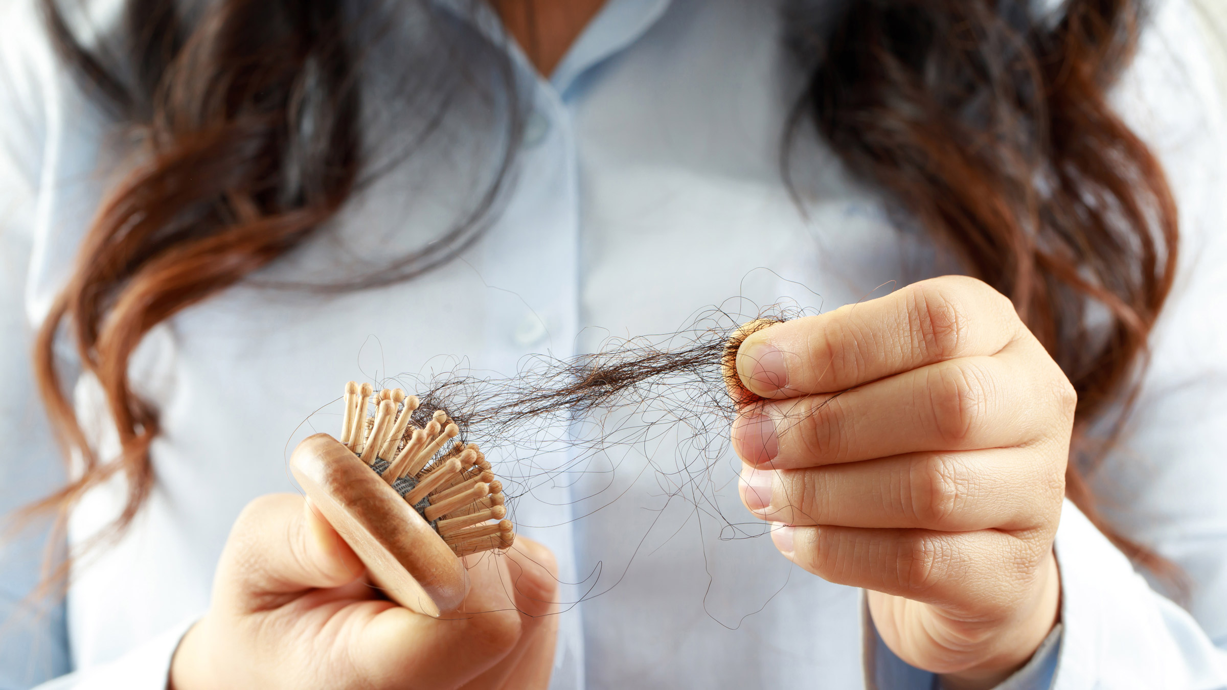 What Causes Hair Loss? 10 Common Culprits - GoodRx