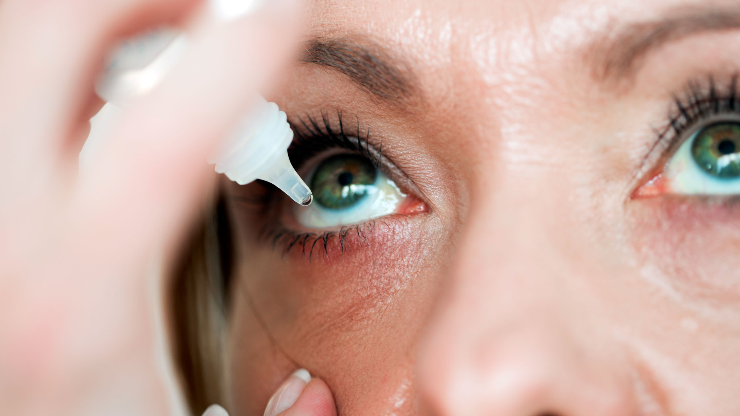 Overview of the Eyelids and Tears - Eye Disorders - Merck Manuals Consumer  Version