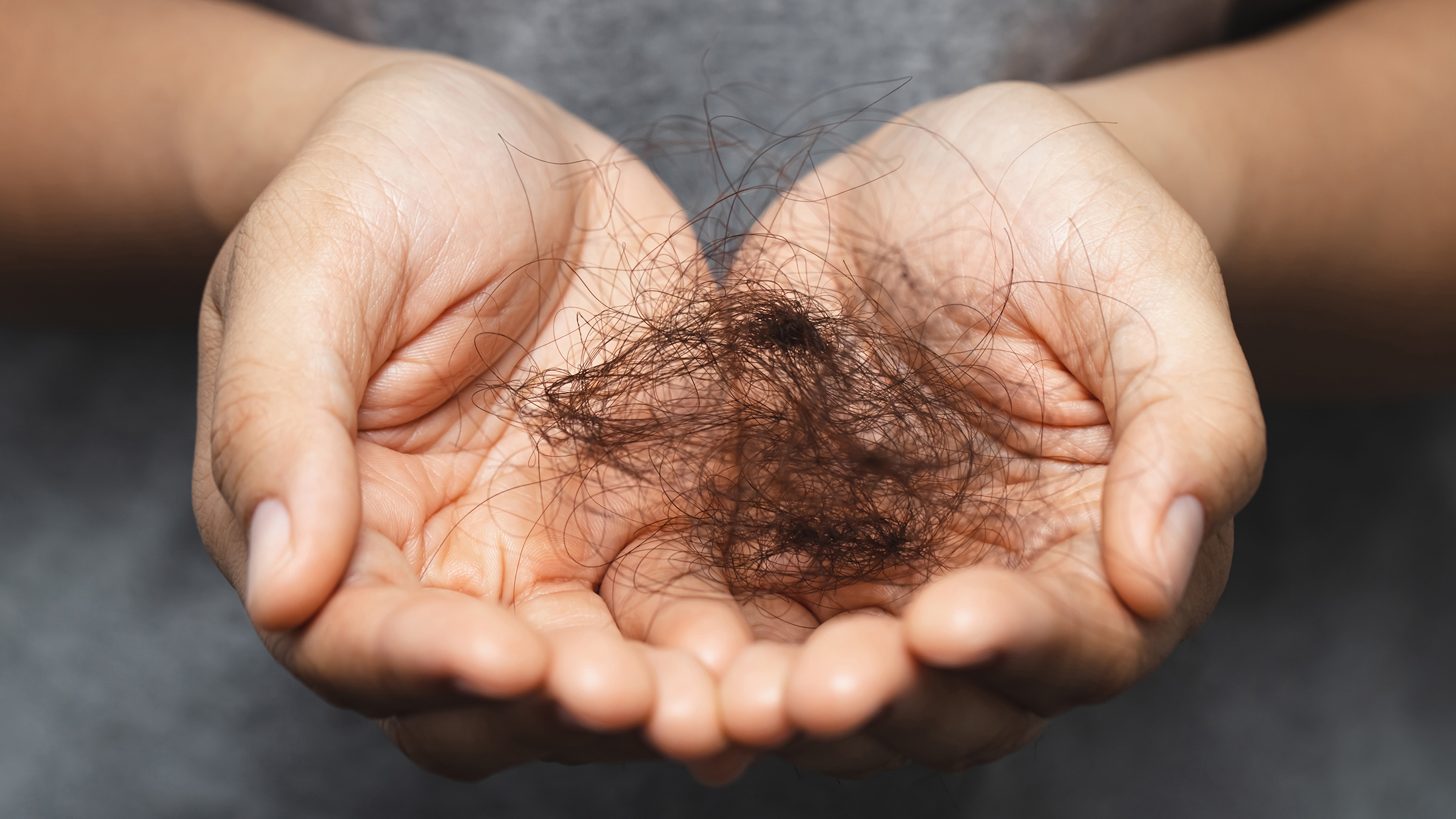 12 Medications That Cause Hair Loss - GoodRx