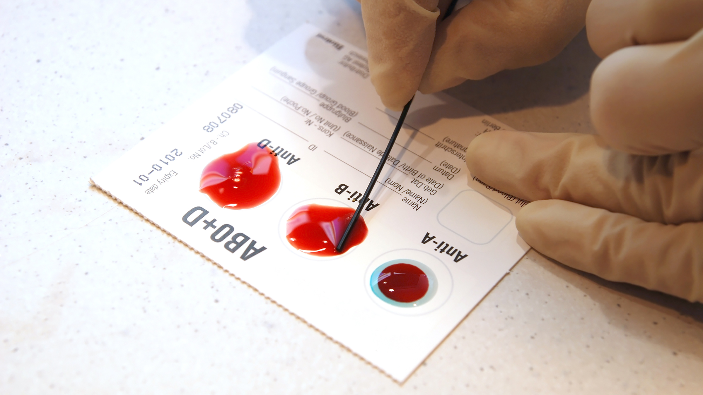 What Is Your Blood Type? What to Know About A, B, AB, and O - GoodRx