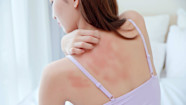 Can You Have An Allergy To Ibuprofen GoodRx