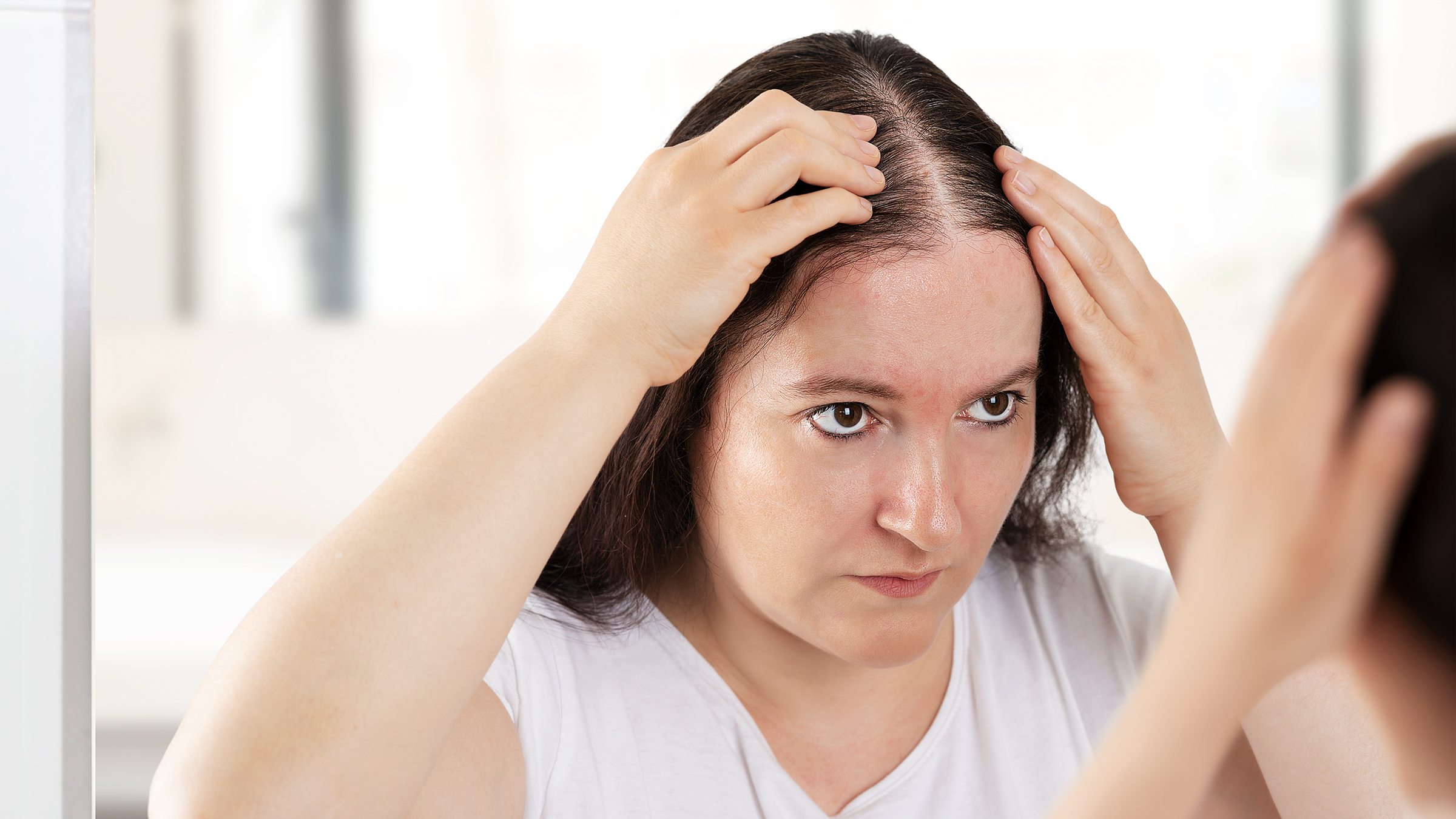 Woman Mirror Hair Loss 1407675558 