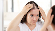 How To Find The Best Treatments For Female Pattern Hair Loss GoodRx