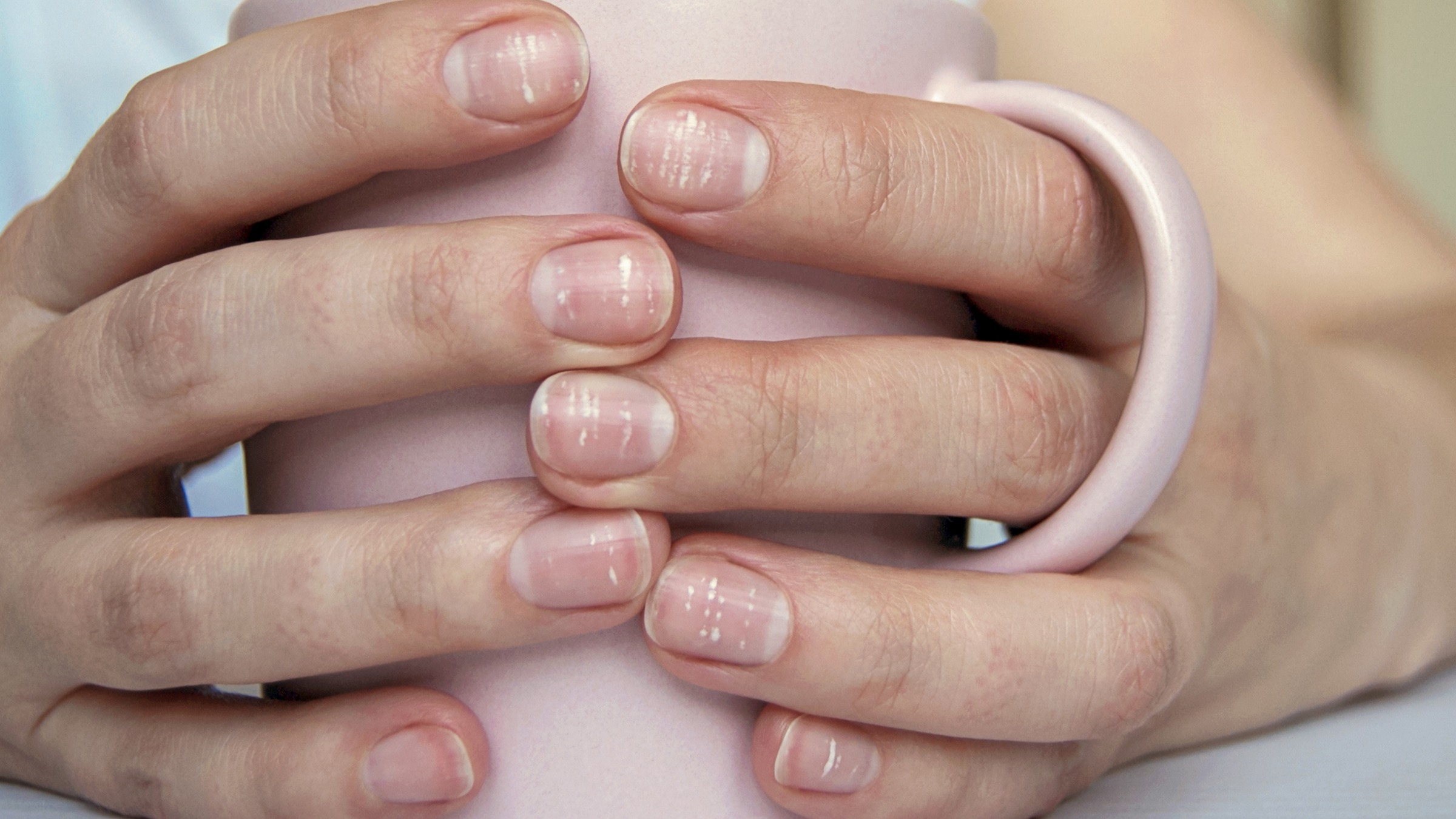 Nail changes during pregnancy  January2016  United Healthcare
