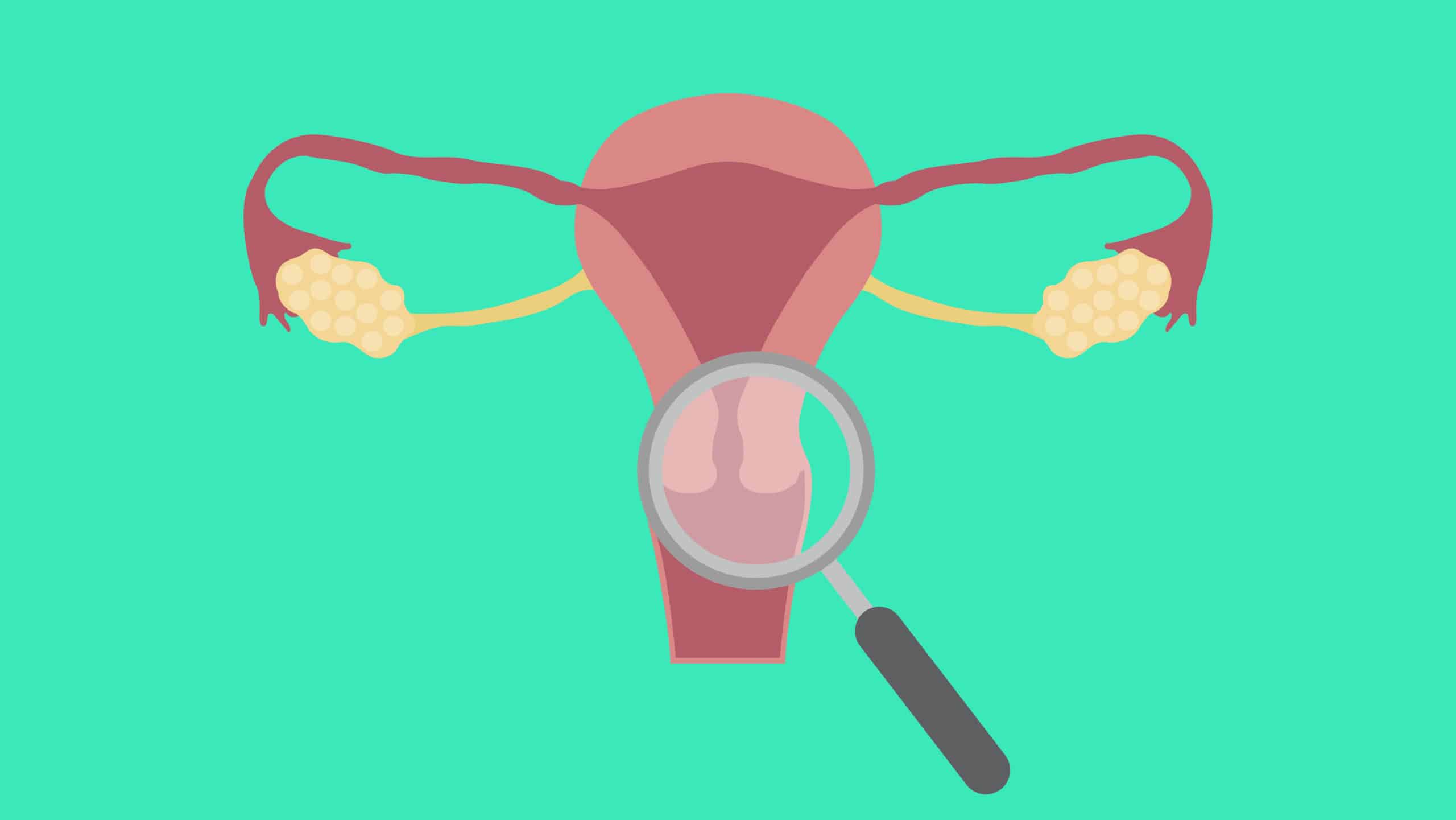 Have a Cervix? This Is How Often to Get a Cervical Cancer Screening