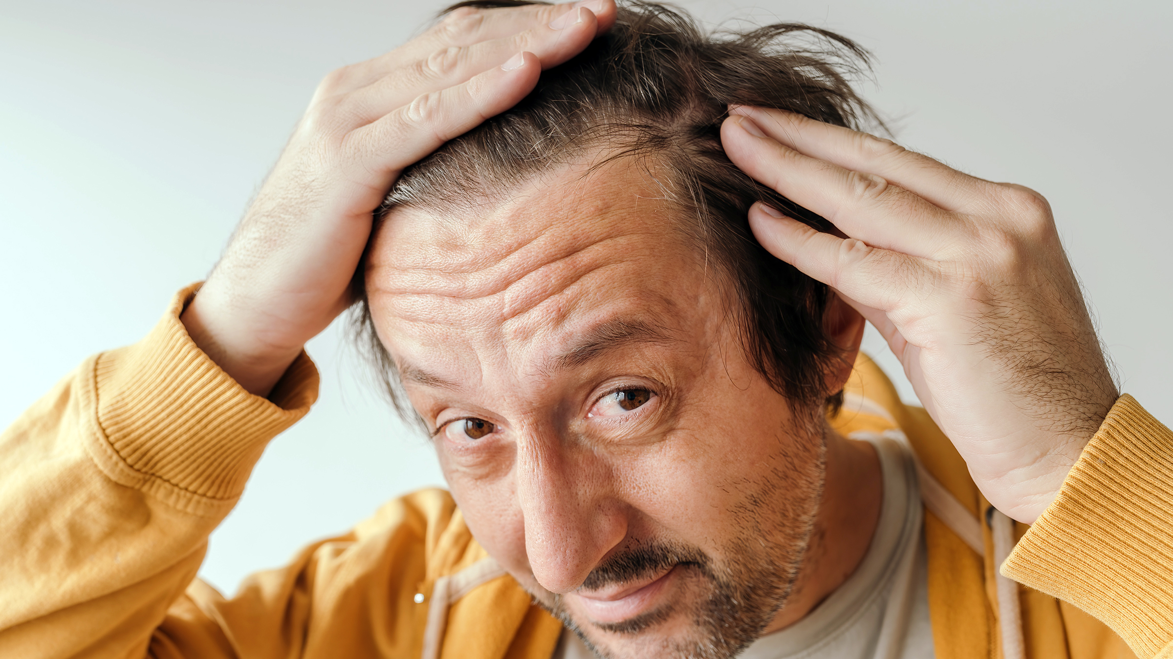 Sexual Side Effects of Minoxidil and How to Manage Them - GoodRx