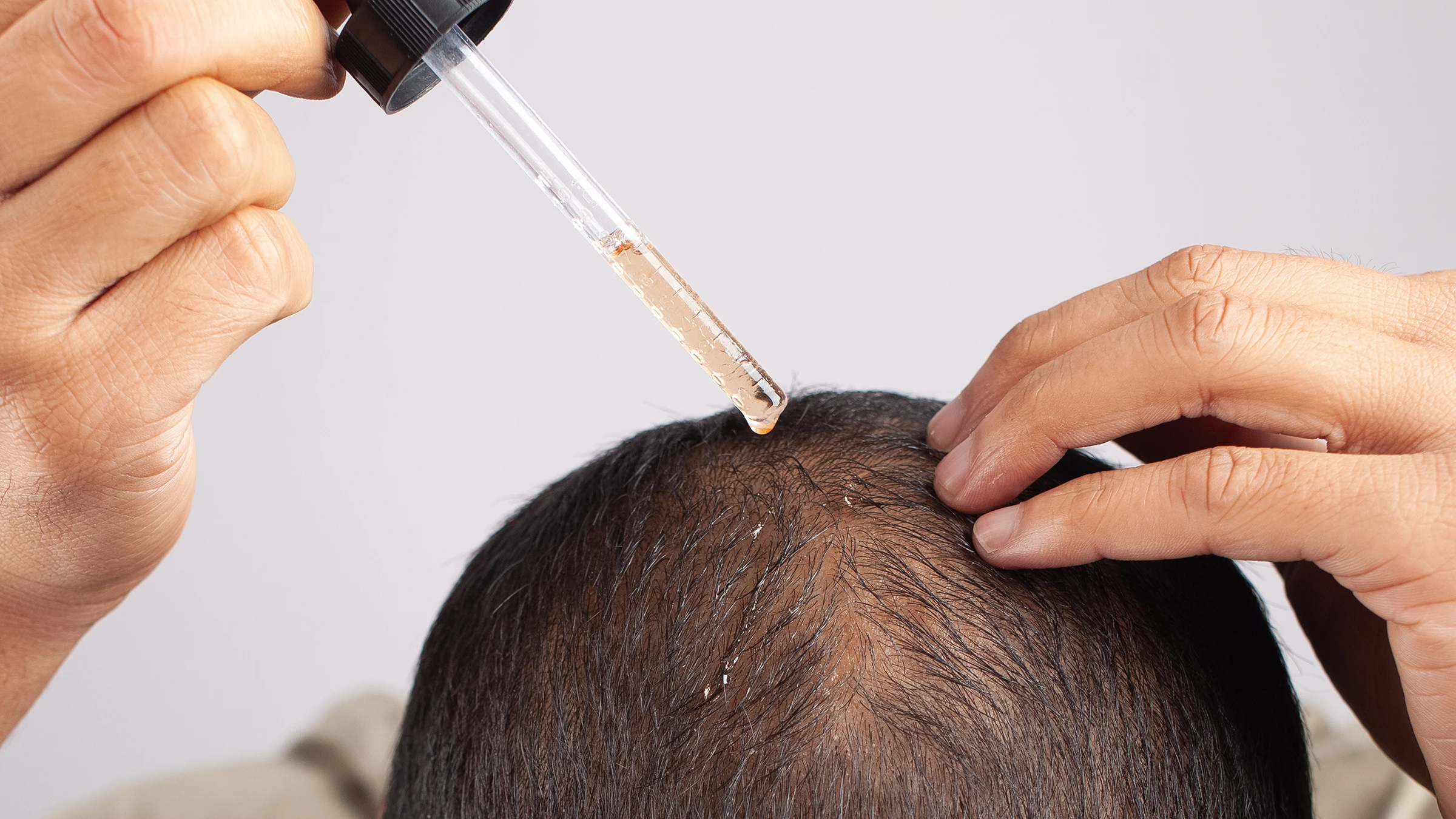 elfbar nachfüll pod läuft aus Does Nicotine Cause Hair Loss?