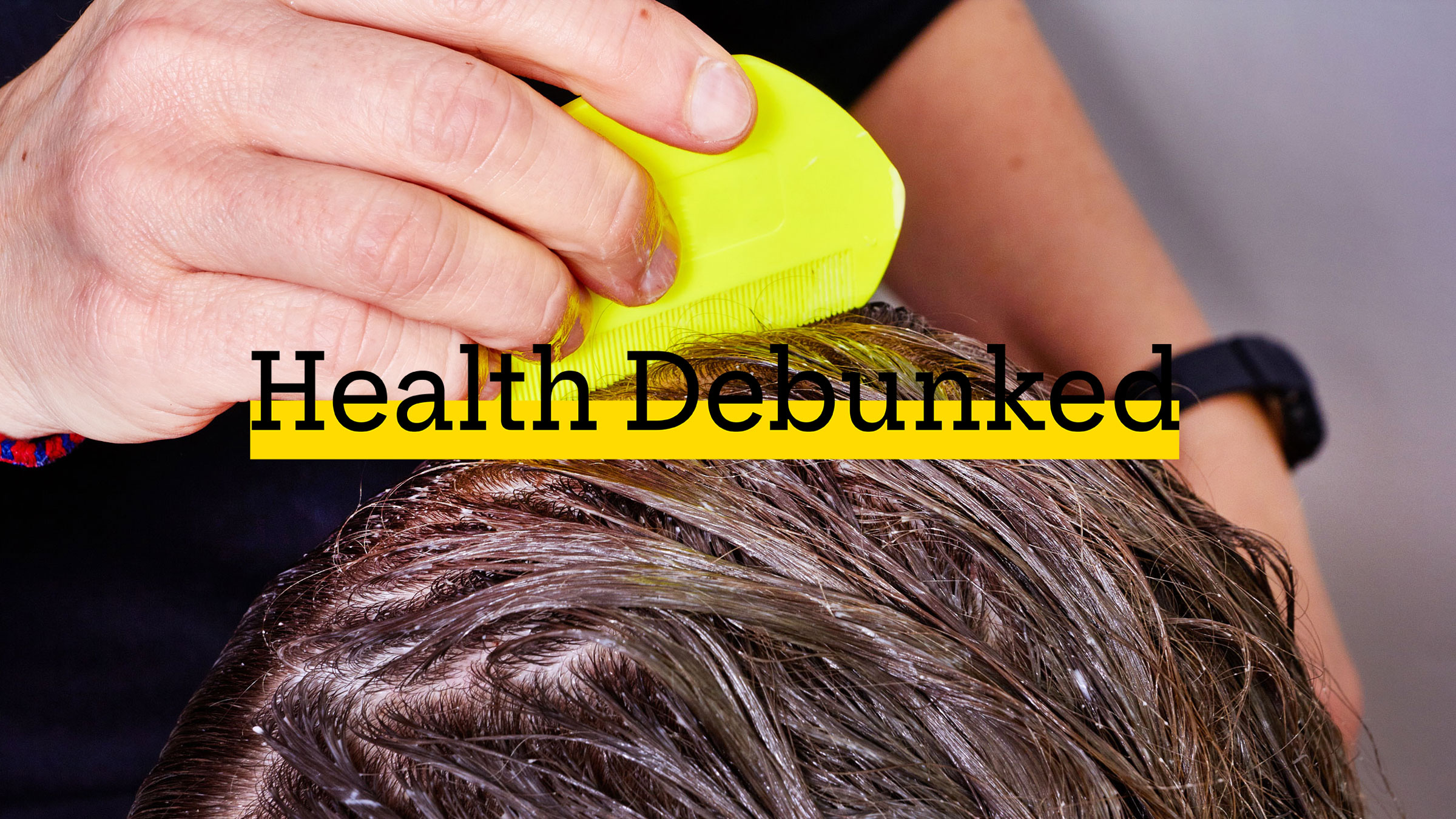 Discover more than 139 hair lice treatment best