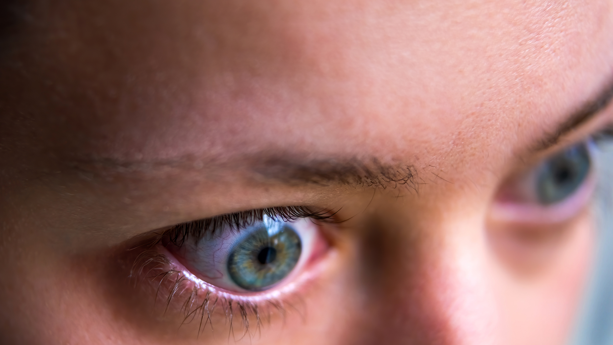 eye: closeup woman with graves disease 1308874500